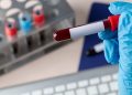 CO2 atmosferic, asociat cu schimbări în sângele uman