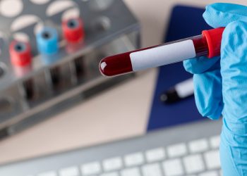 CO2 atmosferic, asociat cu schimbări în sângele uman