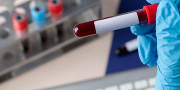 CO2 atmosferic, asociat cu schimbări în sângele uman