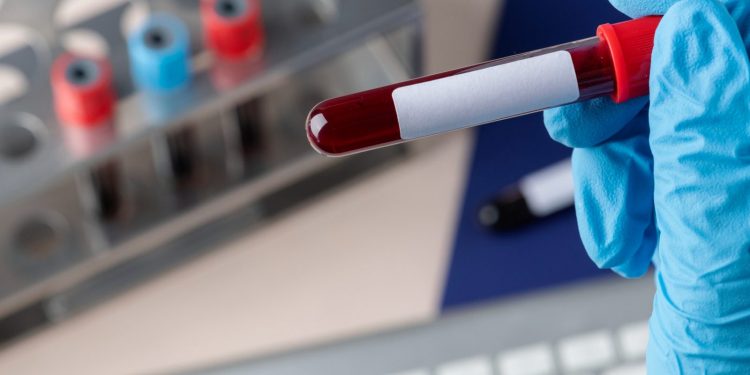 CO2 atmosferic, asociat cu schimbări în sângele uman